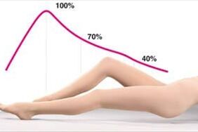 pressure distribution of compression tights on varicose veins