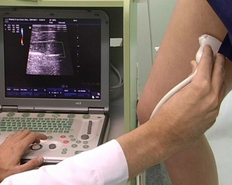 Ultrasound diagnosis of varicose veins